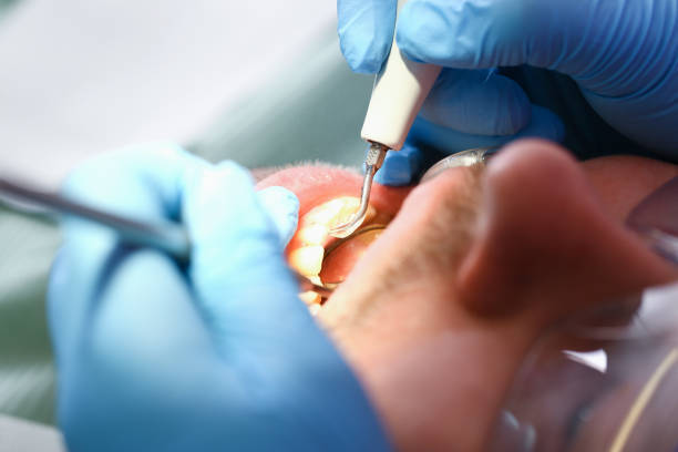 Best Weekend Emergency Dental Services in Arche, OK