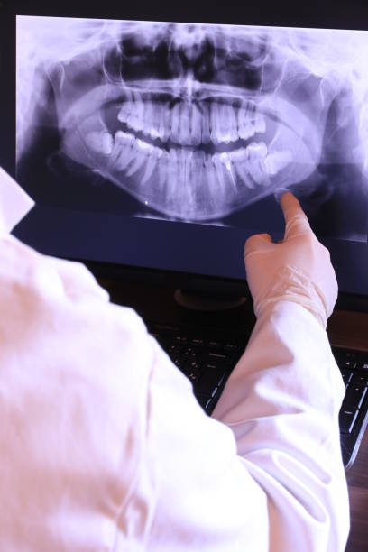 Best Dental Abscess Treatment in Arche, OK