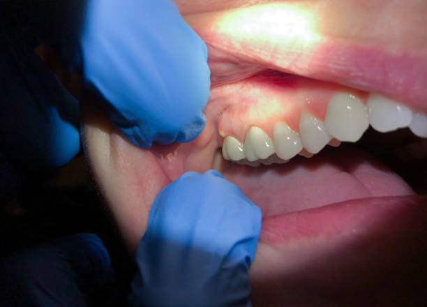 Best Urgent Dental Care for Toothaches in Arche, OK