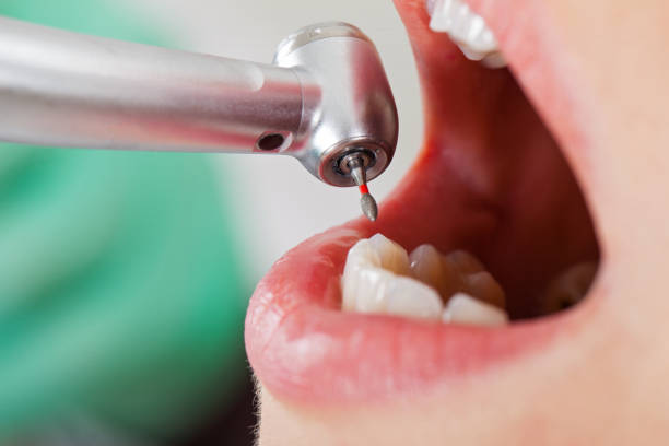 Best Broken or Chipped Tooth Repair in Arche, OK